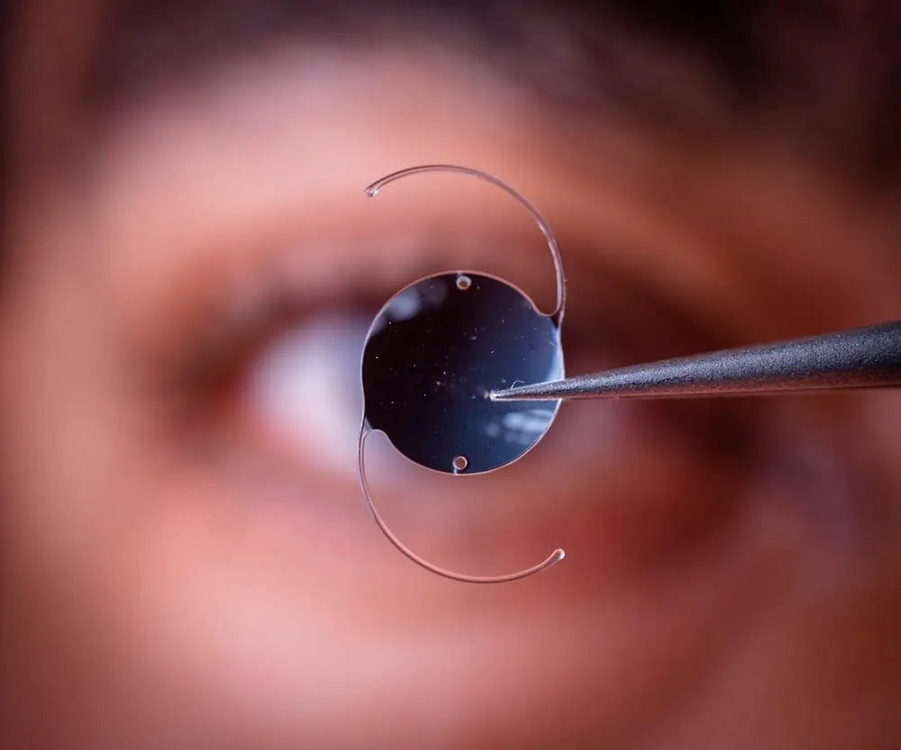 Intraocular lens implant held with forceps in front of an eye